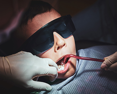 Apical Resection (Surgical) in Turkey