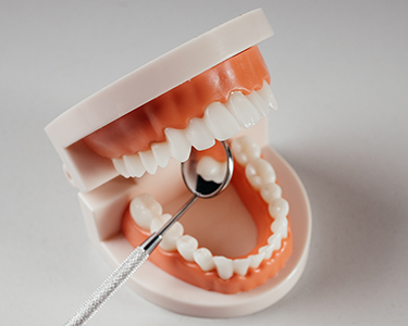 Superficial or Deep Curettage in Turkey