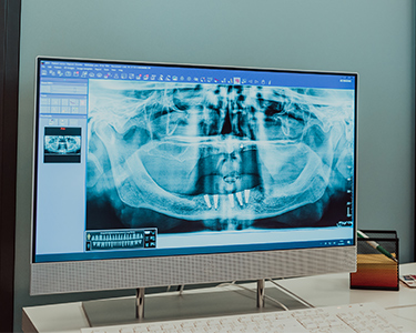 3D Volumetric Dental Tomography in Turkey 