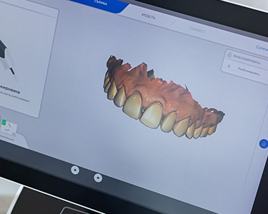 3D Volumetric Dental Tomography in Turkey 