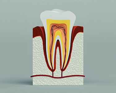 Retreatment in Turkey