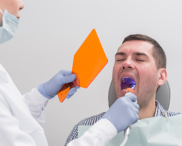 Gingival Depigmentation Procedure in Turkey