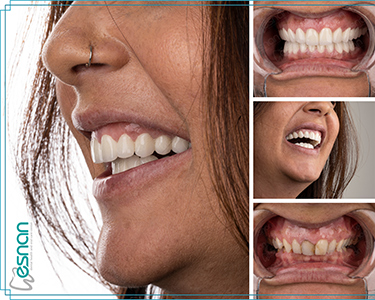 Esnan Dental Clinics