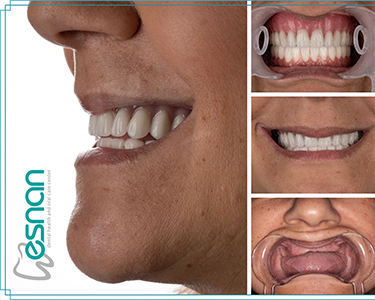 Esnan Dental Clinics