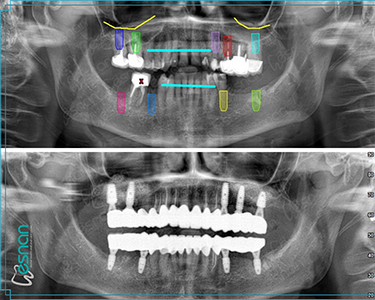 Radiology – Intraoral Diagnosis in Turkey