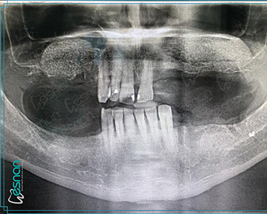 Radiology – Intraoral Diagnosis in Turkey