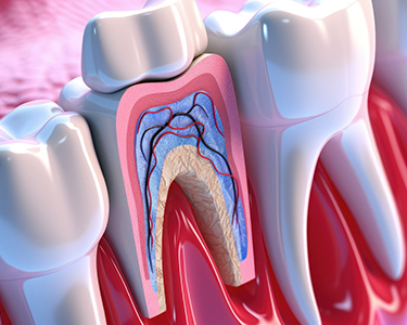 Retreatment in Turkey