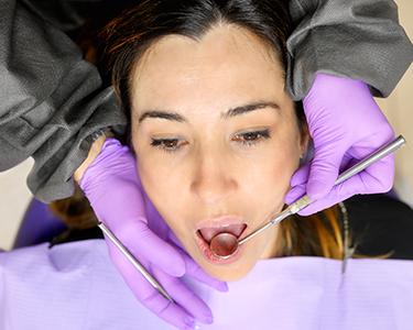 Scaling – Tartar Removal in Turkey