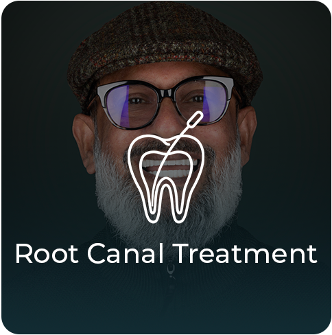 Root-Canal-Treatment