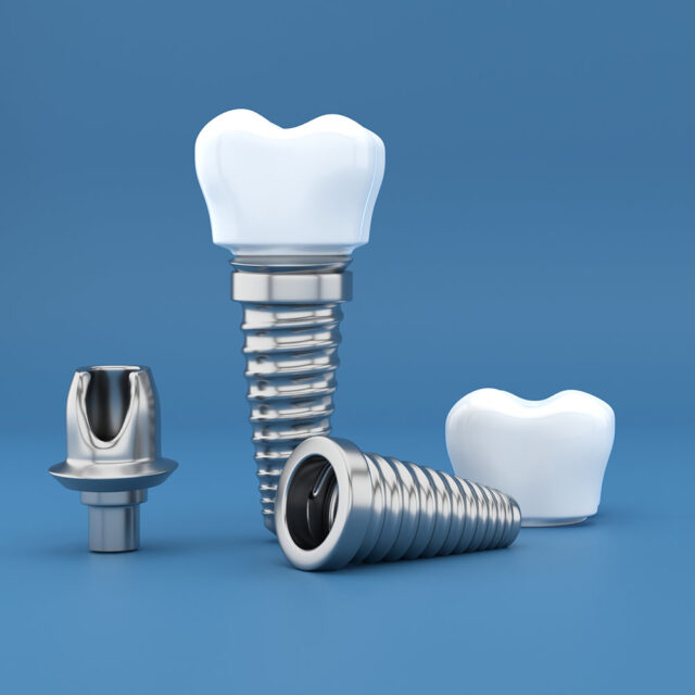 dental-implants-in-Turkey