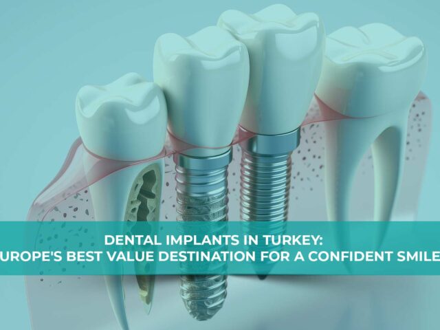 Dental Implants in Turkey : Europe’s Best Value Destination for a Confident Smile