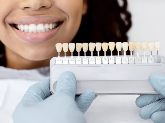 Zirkonyum vs. Porselen Diş Kronları: Hangisi Sizin İçin Uygun?