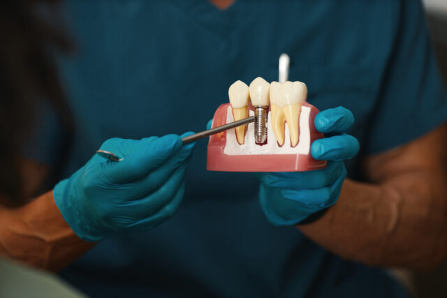 Endodontics Root Canal Treatment in Turkey