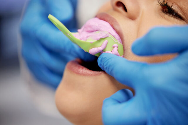 Periodontics Gum Treatment in Turkey
