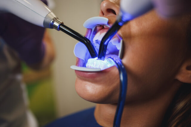 Periodontics Gum Treatment in Turkey