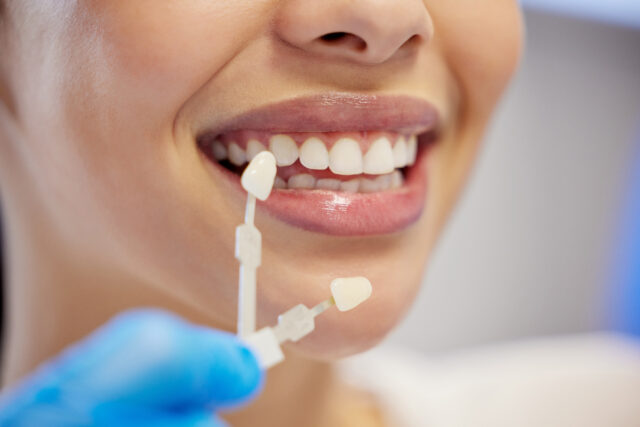 Aesthetic Dental Treatments in Turkey
