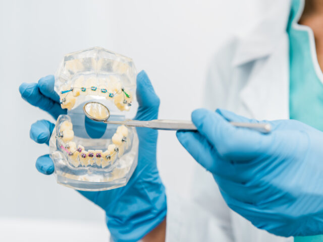 Orthodontic Treatment in Istanbul: Aligners vs. Braces – Finding Your Perfect Smile