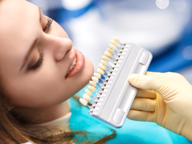 Teeth Whitening in Istanbul: Secrets for a Dazzling Smile