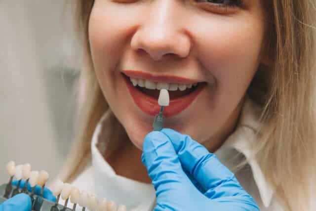 A before and after comparison of a patient's smile after getting dental veneers in Istanbul at Esnan Clinic, resulting in a perfectly aligned, bright smile.