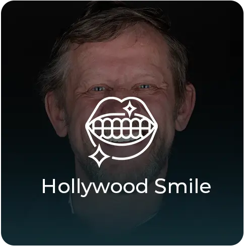 Hollywood Smile in Turkey
