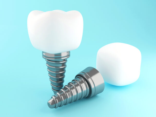 Discover the Benefits of All-on-Four Implants in Istanbul: Top Clinic, Cost, and Expert Care