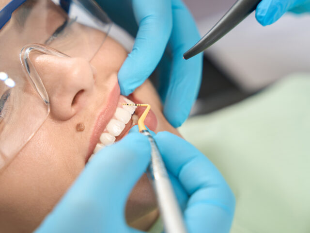 Restorative Dentistry vs Cosmetic Dentistry : Understanding the Difference