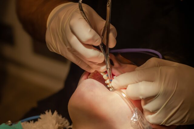 Restorative Dentistry vs Cosmetic Dentistry