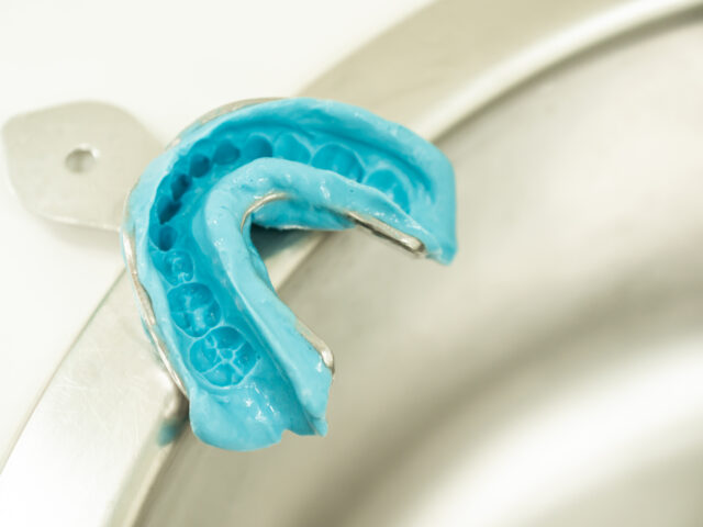 Mouthguards: More Than a Shield – The Art and Science of Comprehensive Protection