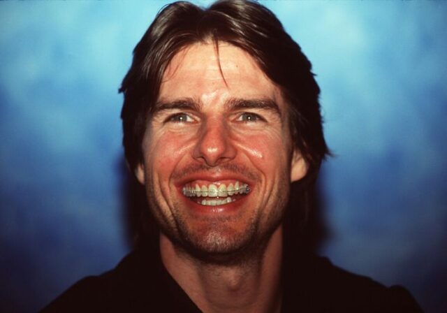 Tom Cruise Teeth