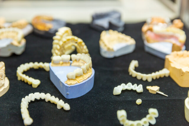 Zirconia vs Monolithic Zirconia
