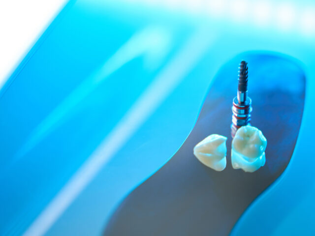Zirconia vs. Monolithic Zirconia: Unveiling the Distinctions in Dental Restorations