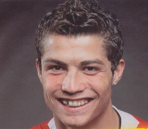 Cristiano Ronaldo teeth